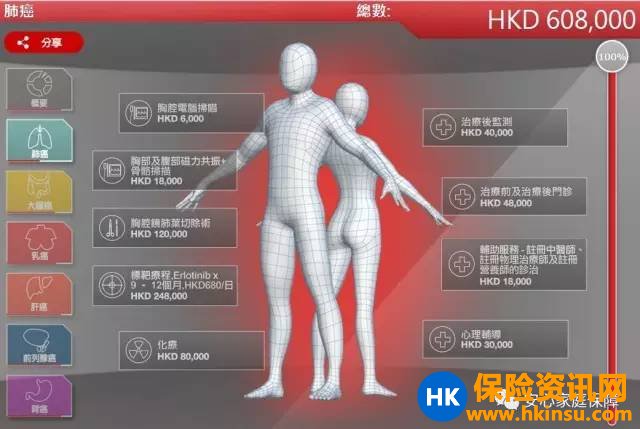 香港的私家医院收费贵吗? 2