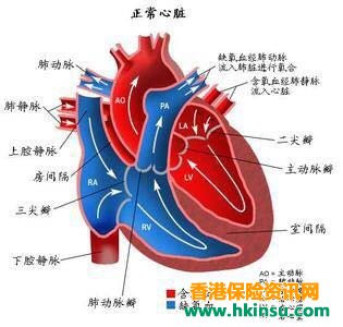 香港保险|儿童重疾常见的核保问题 香港保险|儿童重疾常见的核保问题
